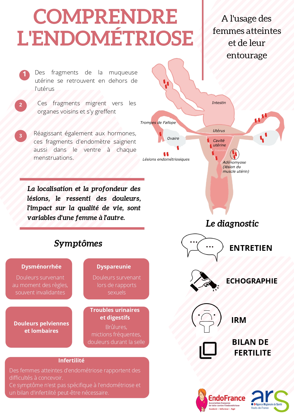 Qu'est-ce que l'endométriose ? (ARS et EndoFrance)